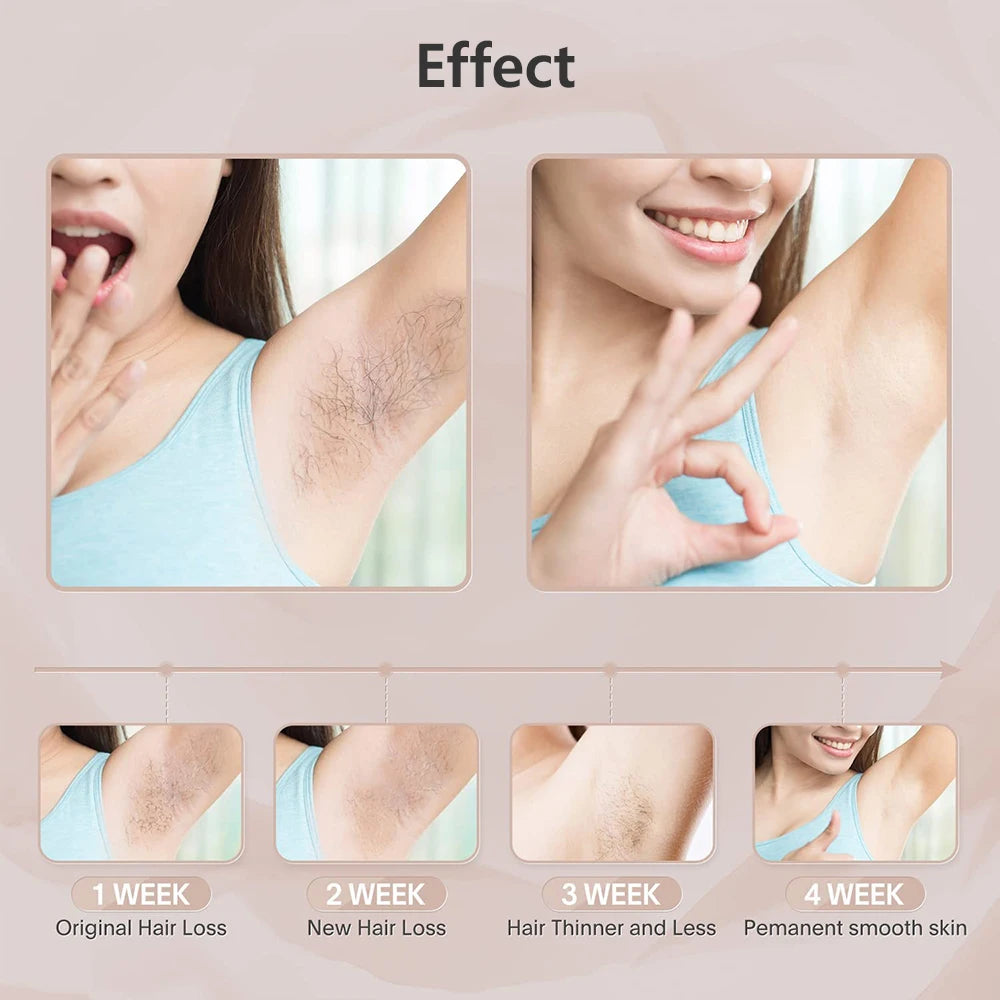Épilateur laser IPL pour femme – épilation du corps, bikini et visage, 990 000 flashs, épilation permanente et indolore.