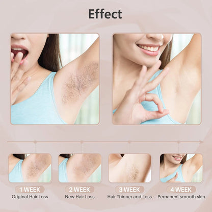 Épilateur laser IPL pour femme – épilation du corps, bikini et visage, 990 000 flashs, épilation permanente et indolore.