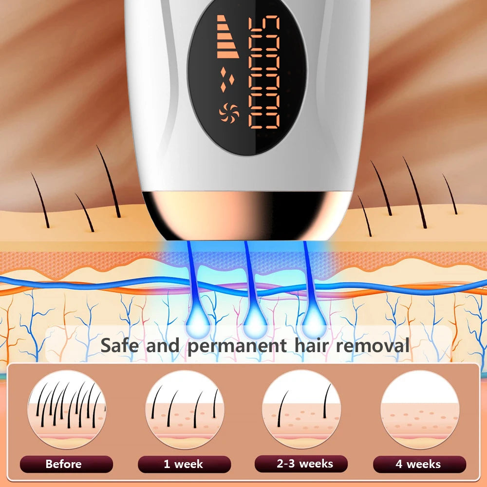 Épilateur laser IPL pour femme – épilation du corps, bikini et visage, 990 000 flashs, épilation permanente et indolore.